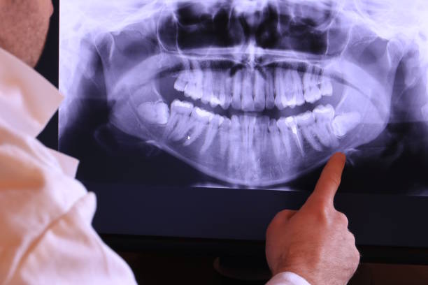 Best 24-Hour Emergency Dental Care in North Arlington, NJ
